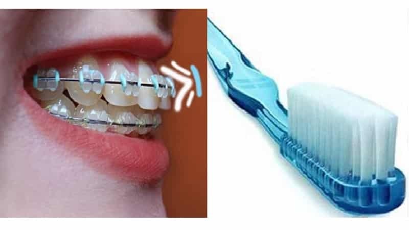 Cepillo de dientes de ortodoncia