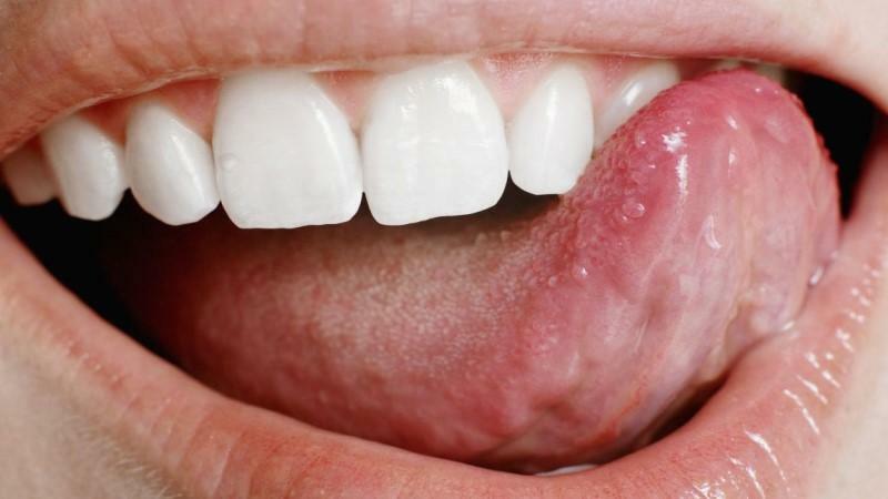 infekcje jamy ustnej