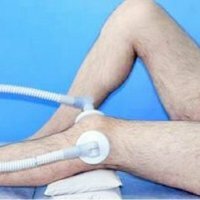 Behandlung des Meniskus des scheibenförmigen Kniegelenks