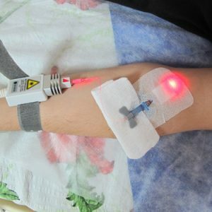 Laser_therapy