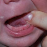 Miten purukumi vauvoilla ennen hampaiden puhkeaminen