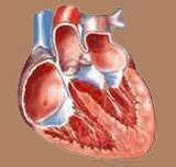 Heart Disease: Angina pectoris