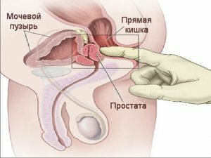 Prostate massage how to do it