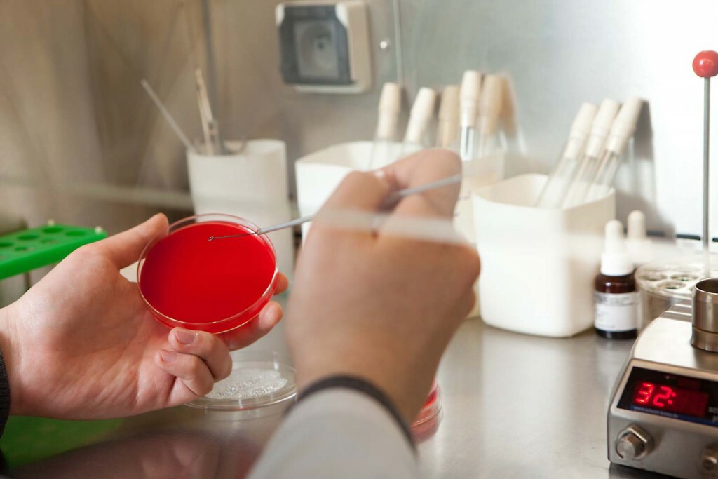 Bakposev urine: regels voor de voorbereiding voor de levering en het decoderen testen