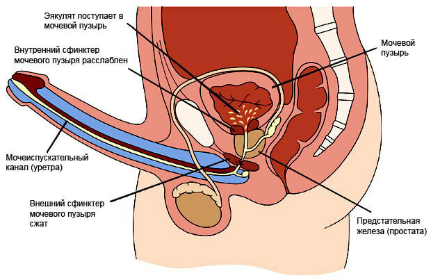 Retrograd ejakulation: årsager, klinisk billede.Diagnose og behandling