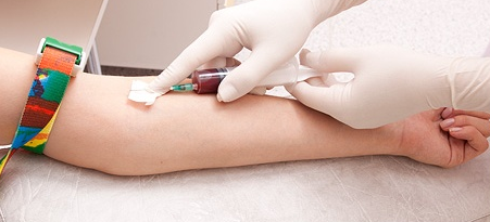 Biokemijski testovi krvi za vrijeme trudnoće