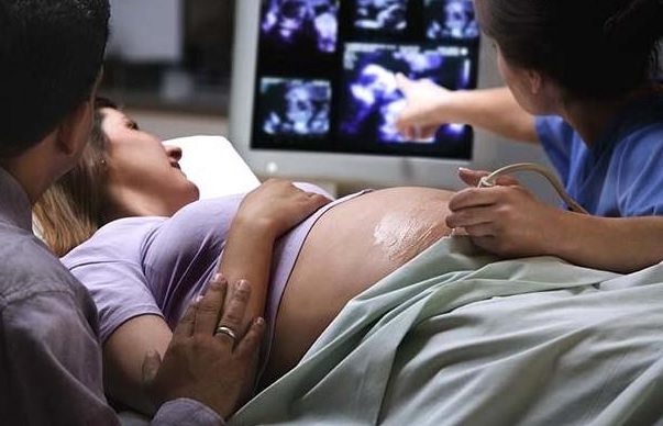 Ventriculomégalie chez le fœtus