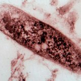 Symptomen en diagnose van tuberculose