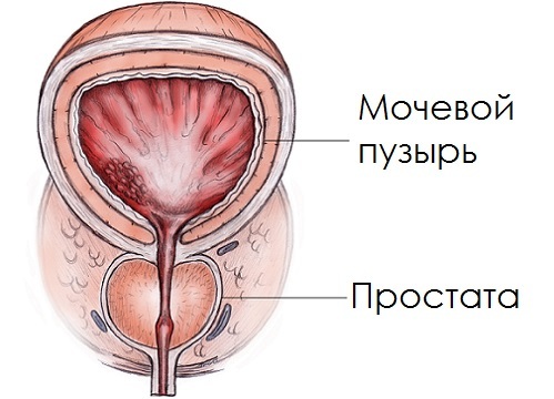 Prostata-Zustand