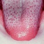 Il rivestimento verde sulla lingua