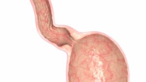 Esophageal canal