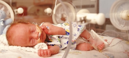 Serebrale oedeem bij pasgeborenen