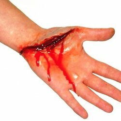 First aid for bleeding