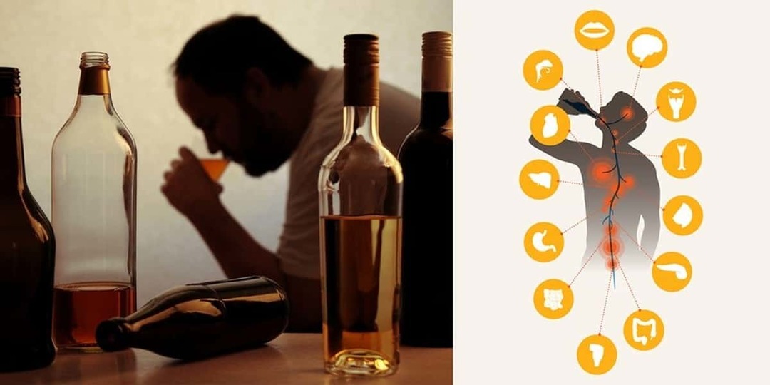 Faze i stupnjevi alkoholizma: glavne manifestacije, posljedice i terapija ovisnosti o alkoholu