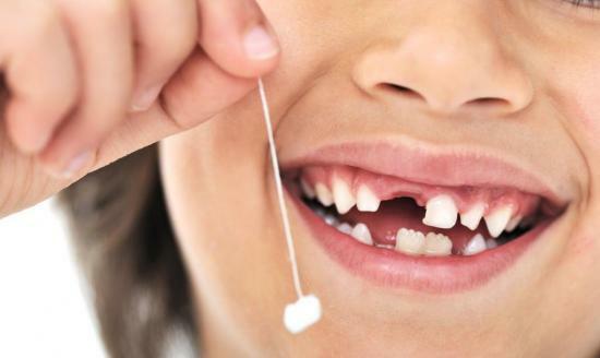 Quais são os dentes de crianças abandonam a primeira: esquema de estudo