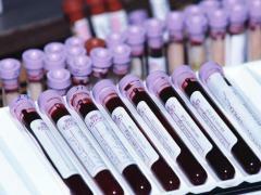 Krvný test pomáha identifikovať mnoho chorôb