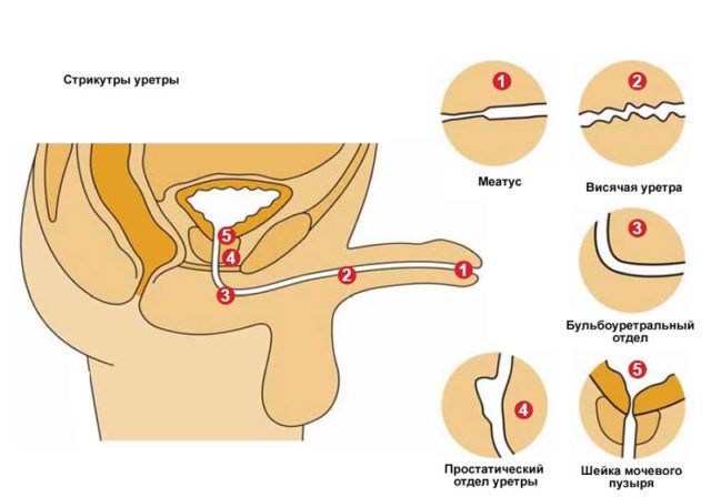Vlastnosti striktúry močovej trubice u mužov
