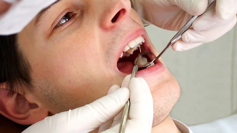 Warum geschwollenes Zahnfleisch