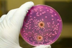 Salmonella-Bakterien auf Laborglas