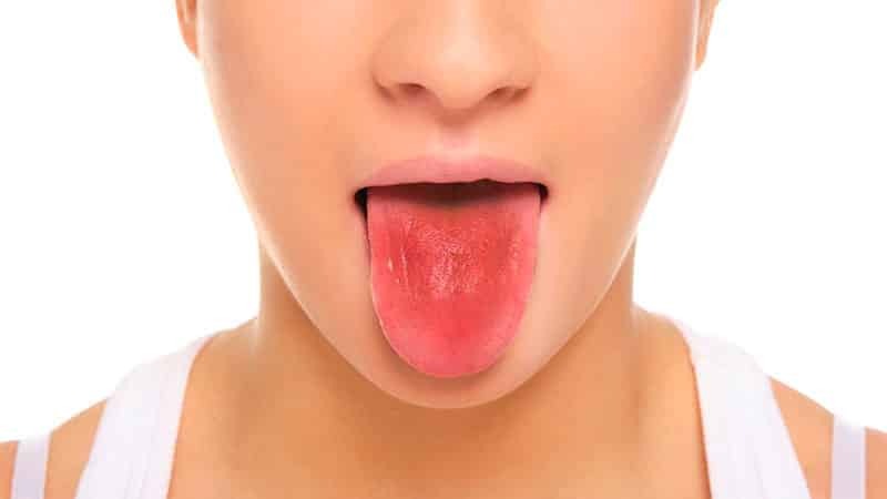Il rivestimento verde sulla lingua