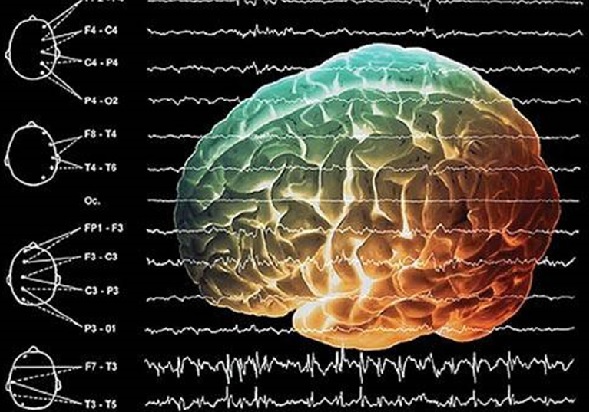 Umjereno su izražene difuzne promjene u bioelektričnoj aktivnosti mozga
