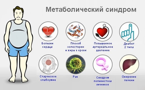 Metabolic-syndrome-for-obesity