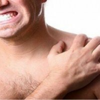 Periarthritis of the shoulder joint