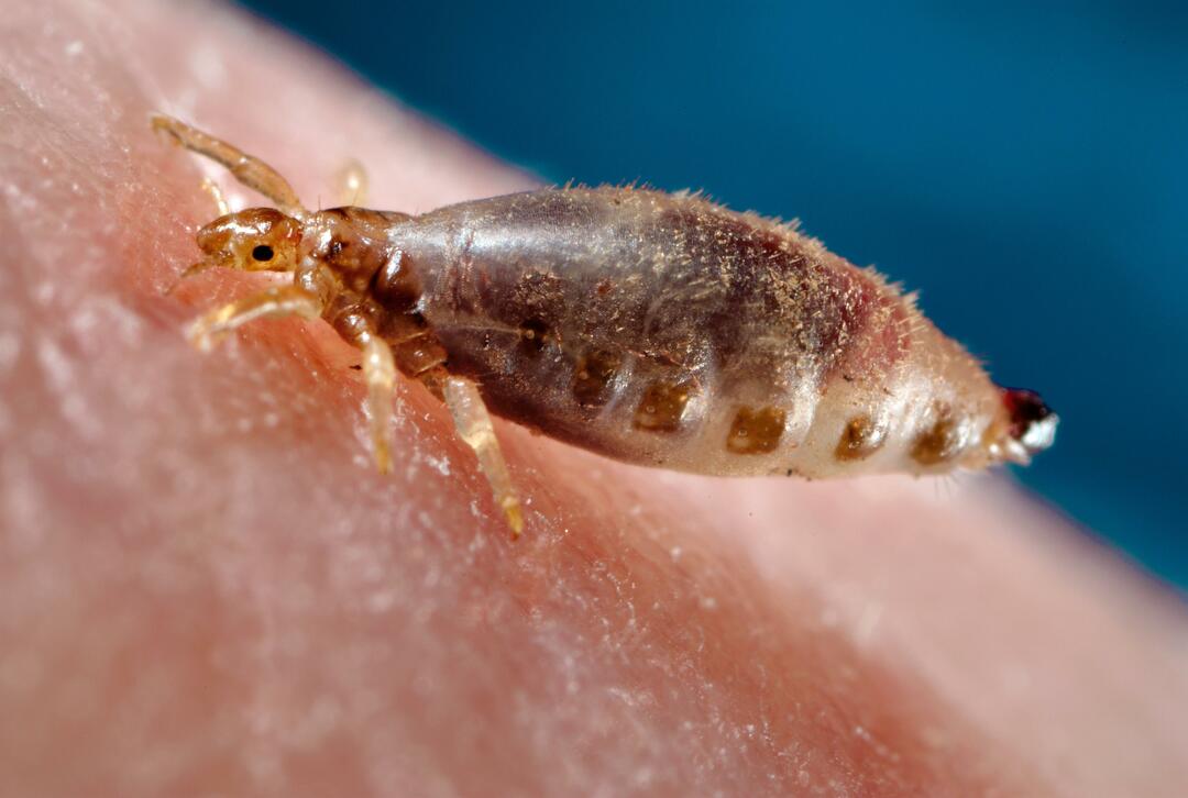 Pediculosis: signs, ways of infection, methods of treatment and prevention