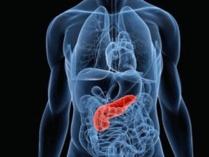 Pancreasontsteking