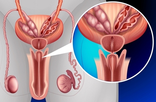 Hva er den normale størrelsen på prostata kjertelen?