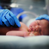 Congenital hypothyroidism in a newborn