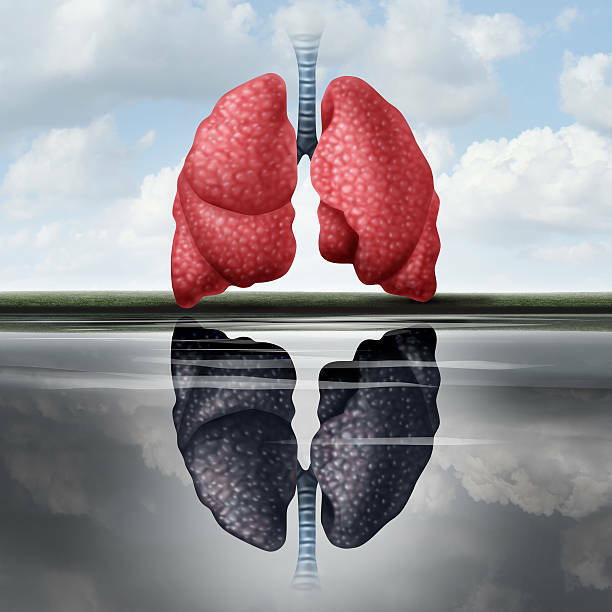 Keuhkojen antrakoosi: mikä se on, syyt, oireet, hoito