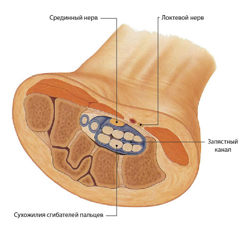 Uzroci sindrom karpalnog tunela