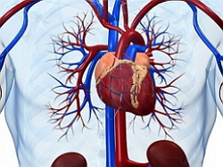 cardiosclerosis