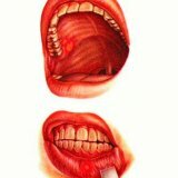 Značajke tijeka gnusnih upalnih bolesti usne šupljine