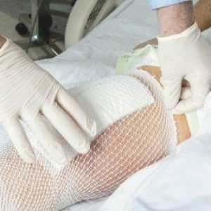 How-to-treat-diabetic-wounds