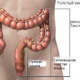 Symptomen van de rectumziekte