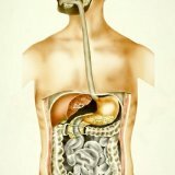 Symptomen van een hernia van de slokdarm