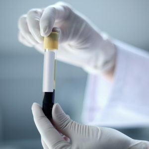 Des tests sanguins pour les hormones de la thyroïde