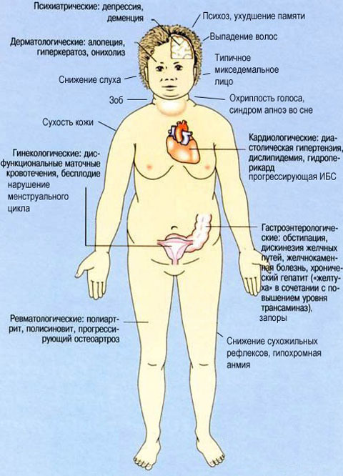 Symptomen van hypothyreoïdie schildklier