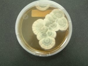 Molde do gênero Penicillium