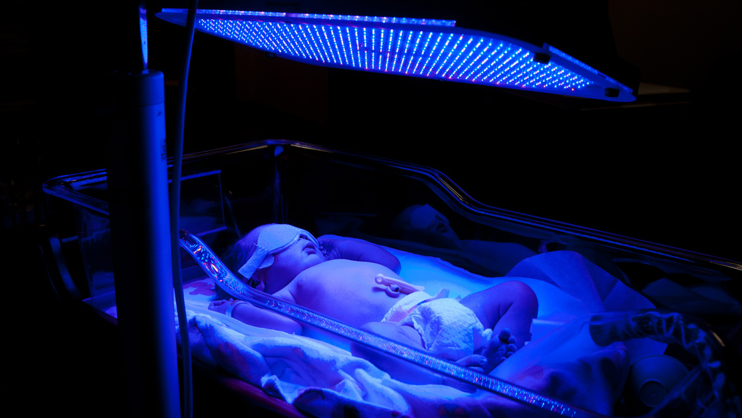 BEHANDELING neonatale geelzucht