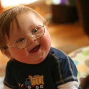 Downi sündroomiga lastel - mida vanemad peavad teadma