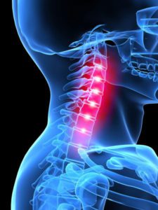A gerinc spondylosis