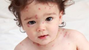 Vesirokkovirus