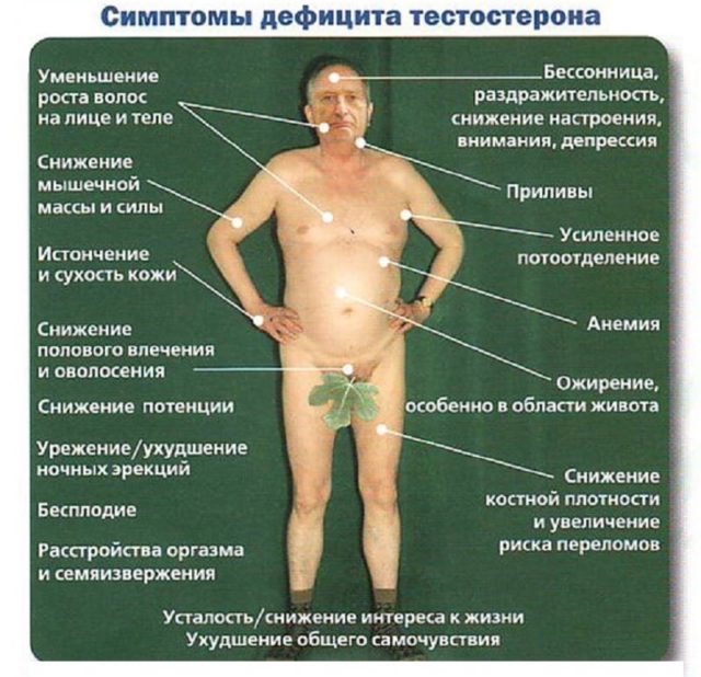 Causes and treatment of hypogonadism in men