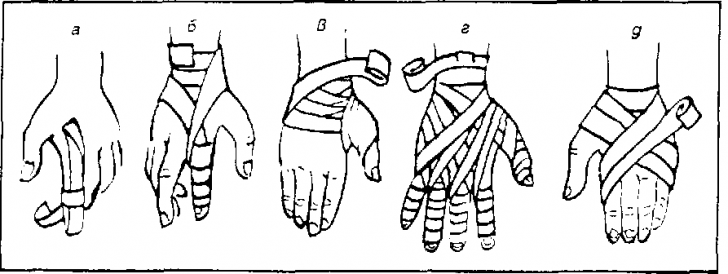 Glove bandage