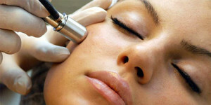 Alt hvad du behøver at vide om acne fjernelse med laser - pris og anmeldelser