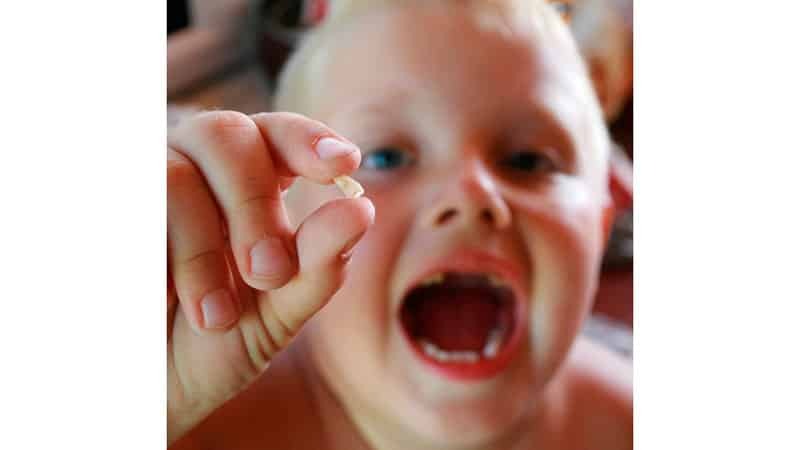 Strata primárnych zubov u detí - Photo