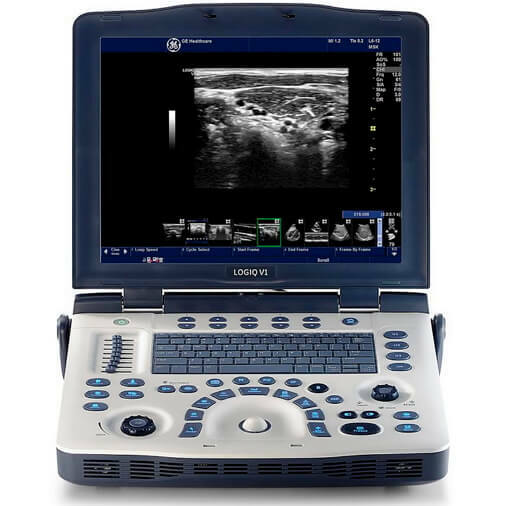 Scope of portable ultrasound devices